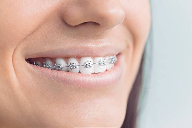 Best Traditional Braces  in Prces Lakes, IN